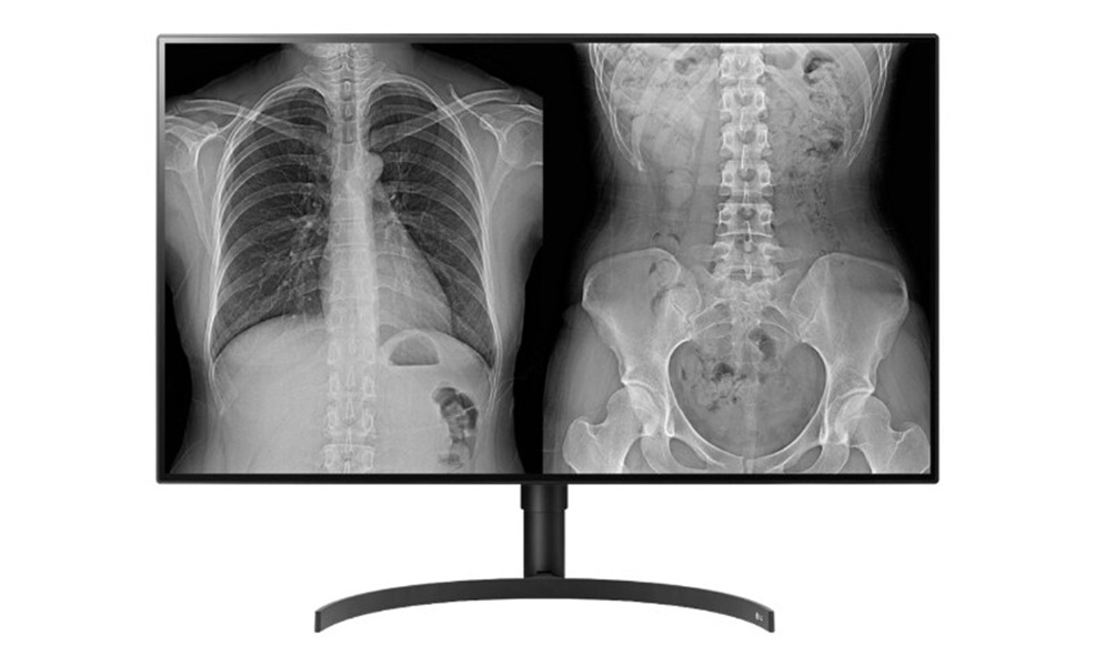 32" LG 8MP DIAGNOSTIC MONITOR