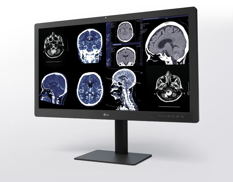 32" LG IPS Black 8MP DIAGNOSTIC MONITOR