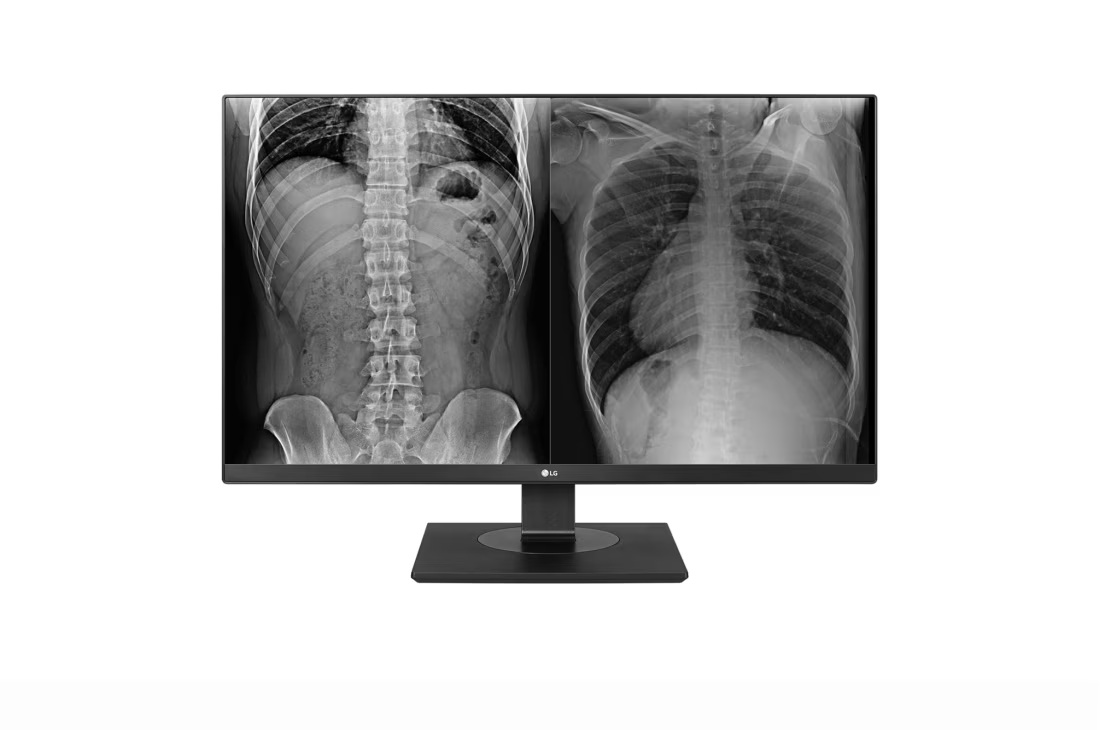 27" LG 8MP CLINICAL MONITOR BLACK