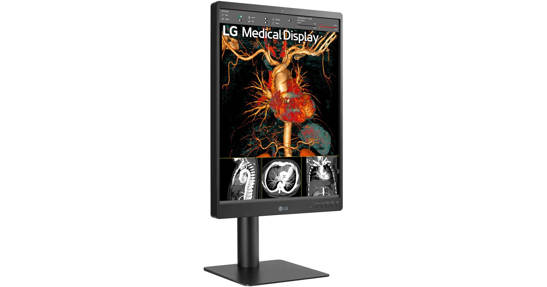 21" LG 5MP DIAGNOSTIC MONITOR