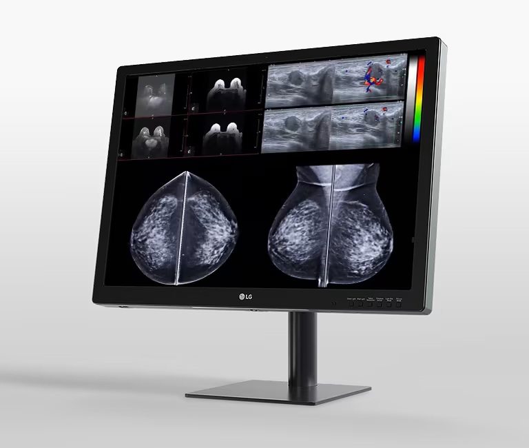 31" LG 12MP DIGNOSTIC MONITOR