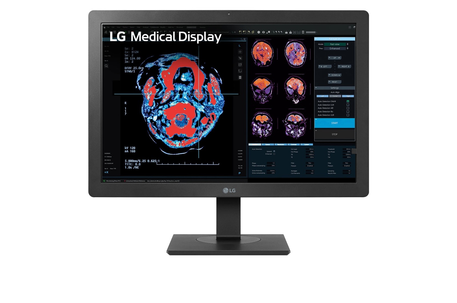 24" LG 2MP DIAGNOSTIC MONITOR