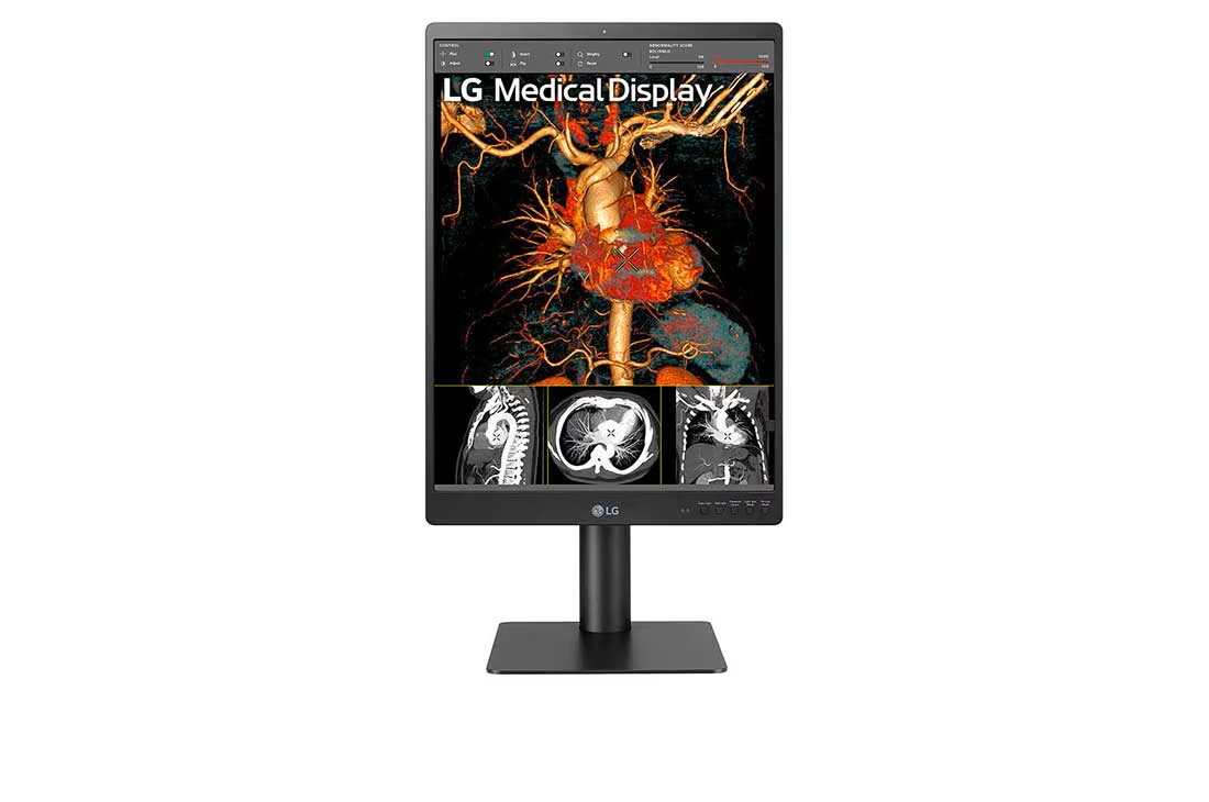 21" LG 3MP DIAGNOSTIC MONITOR